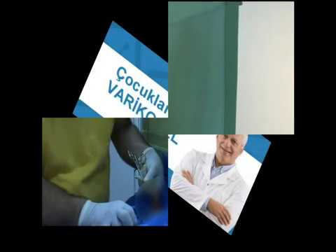 Bebek ve Çocuklarda Kasık Şişlikleri