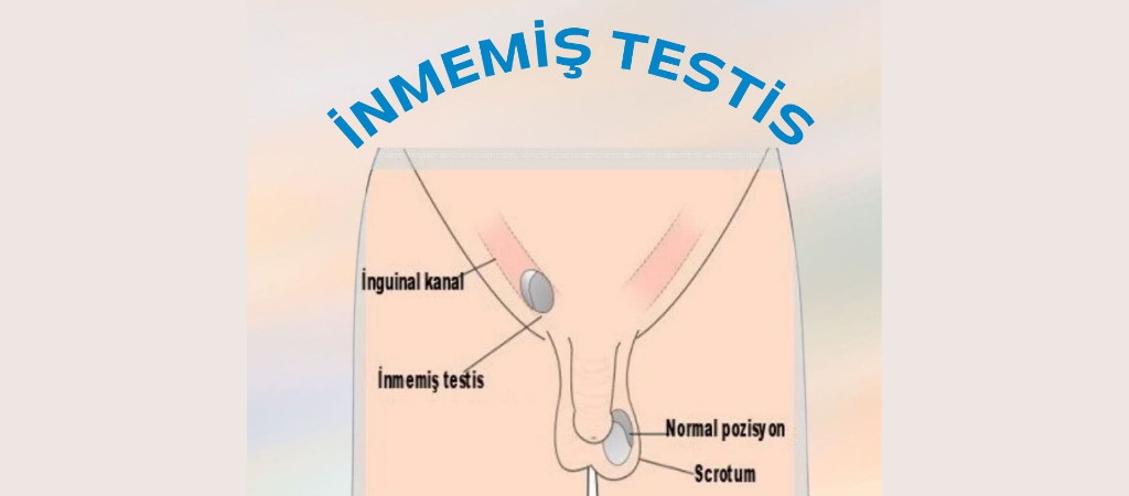 İnmemiş testisin zararları nelerdir ?