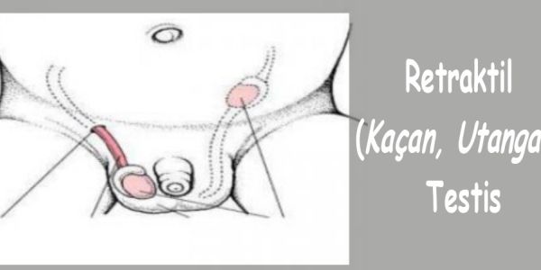 Retraktil (Ka&ccedil;an, Utanga&ccedil;) Testis
