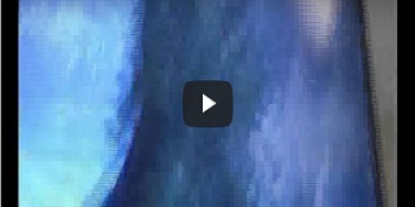 Acı ve Ağrı Olmadan S&uuml;nnet &Ouml;ncesi Uyuşturma